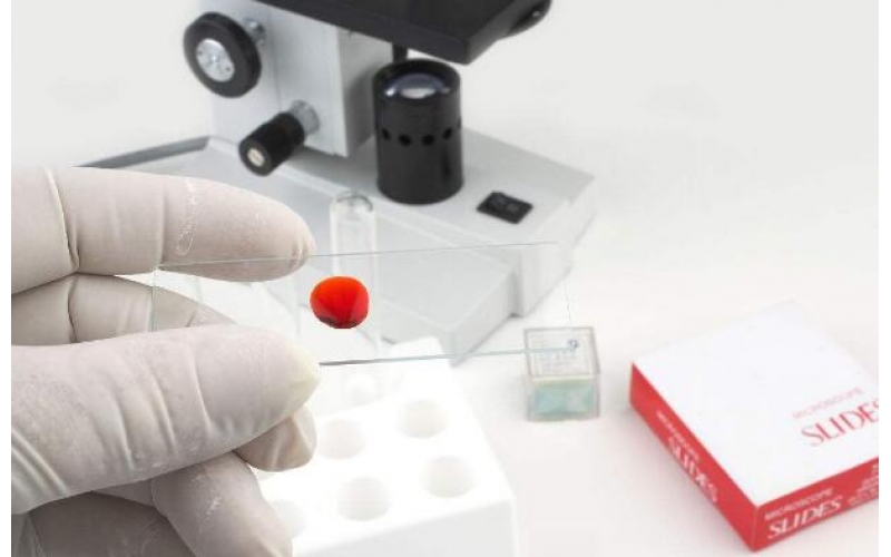 冬季空氣濕度也會(huì)影響甲醛檢測(cè)人體的健康